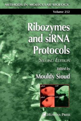 Carte Ribozymes and siRNA protocols Mouldy Sioud