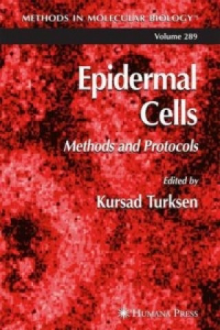 Carte Epidermal Cells 