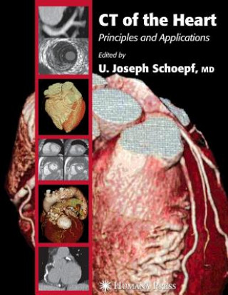 Carte CT of the Heart U. Joseph Schoepf