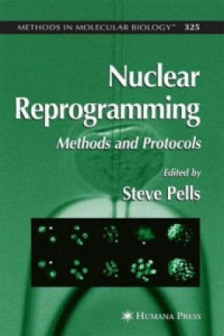 Carte Nuclear Reprogramming Steve Pells