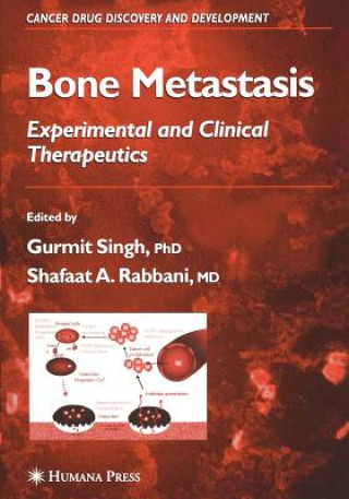 Kniha Bone Metastasis Gurmit Singh