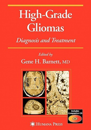 Carte High-Grade Gliomas Gene H. Barnett