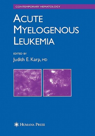 Kniha Acute Myelogenous Leukemia Judith E. Karp