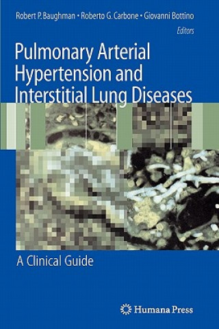 Carte Pulmonary Arterial Hypertension and Interstitial Lung Diseases Robert P. Baughman