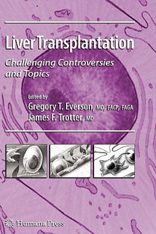 Kniha Liver Transplantation Gregory T. Everson