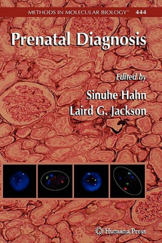 Kniha Prenatal Diagnosis Sinuhe Hahn