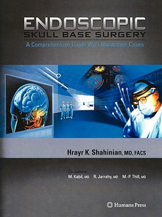 Livre Endoscopic Skull Base Surgery Hrayr K. Shahinian