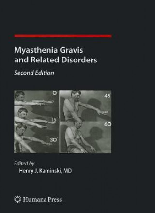 Könyv Myasthenia Gravis and Related Disorders Henry J. Kaminski