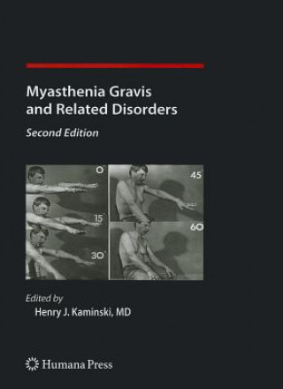 Βιβλίο Myasthenia Gravis and Related Disorders Henry J. Kaminski