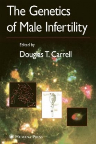 Knjiga Genetics of Male Infertility Lori Barnard