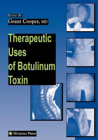Kniha Therapeutic Uses of Botulinum Toxin Grant Cooper