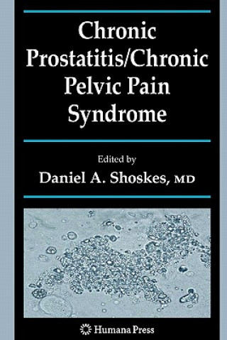 Kniha Chronic Prostatitis/Chronic Pelvic Pain Syndrome Daniel A. Shoskes