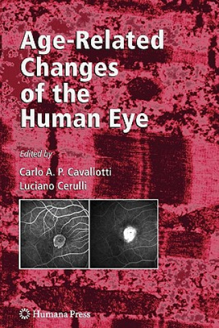 Carte Age-Related Changes of the Human Eye Carlo Cavallotti