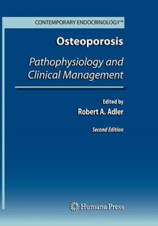 Könyv Osteoporosis Robert A. Adler