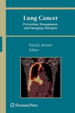 Книга Lung Cancer: David J. Stewart