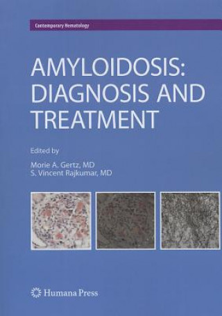 Книга Amyloidosis Morie A. Gertz