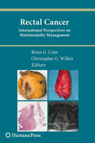 Buch Rectal Cancer Brian G. Czito