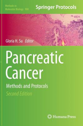 Könyv Pancreatic Cancer Gloria H. Su