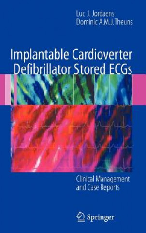 Książka Implantable Cardioverter Defibrillator Stored ECGs Luc J. Jordaens
