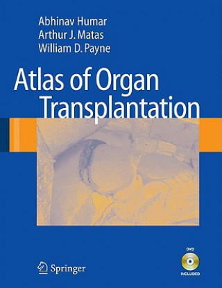 Könyv Atlas of Organ Transplantation Abhinav Humar