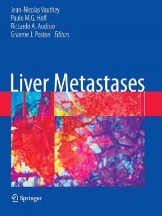 Kniha Liver Metastases Jean-Nicolas Vauthey