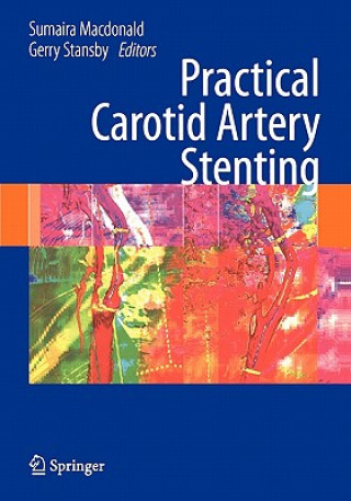 Könyv Practical Carotid Artery Stenting Sumaira Macdonald