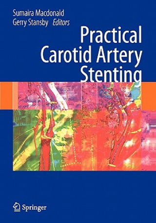 Knjiga Practical Carotid Artery Stenting Sumaira Macdonald