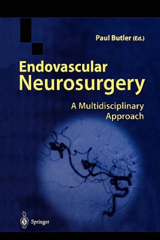 Carte Endovascular Neurosurgery Paul Butler