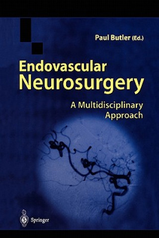 Kniha Endovascular Neurosurgery Paul Butler