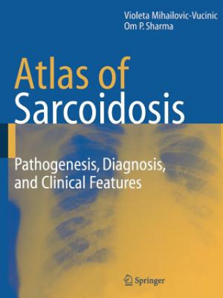 Kniha Atlas of Sarcoidosis Violeta Mihailovic-Vucinic