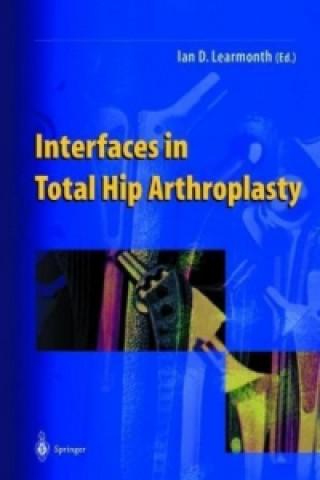 Kniha Interfaces in Total Hip Arthroplasty Ian D. Learmonth