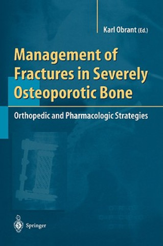Kniha Management of Fractures in Severely Osteoporotic Bone Karl Obrant