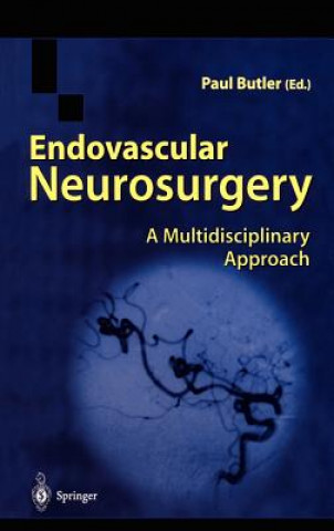 Książka Endovascular Neurosurgery Paul Butler
