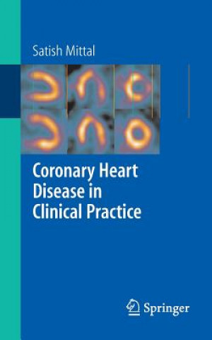 Book Coronary Heart Disease in Clinical Practice Satish Mittal