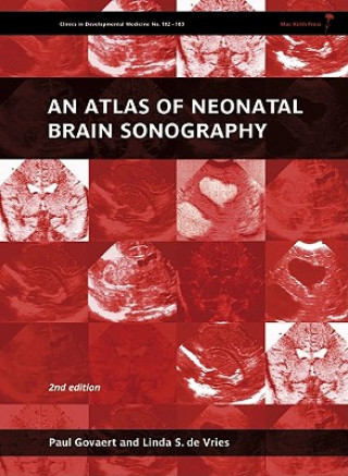Könyv Atlas of Neonatal Brain Sonography - Clinics in Developmental Medicine Paul Govaert