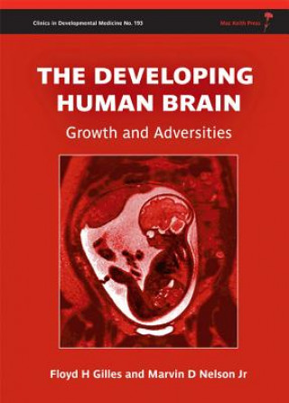 Carte Developing Human Brain - Growth and Adversities Floyd H. Gilles