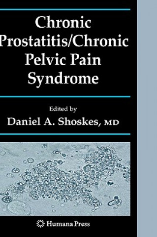 Книга Chronic Prostatitis/Chronic Pelvic Pain Syndrome Daniel A. Shoskes