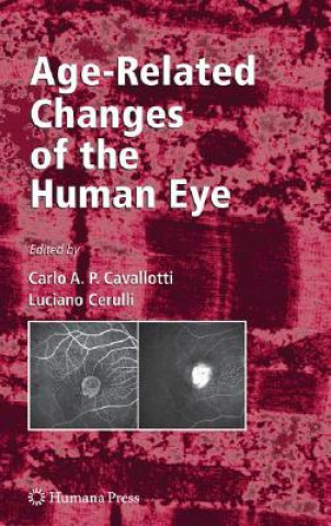 Kniha Age-Related Changes of the Human Eye Carlo Cavallotti