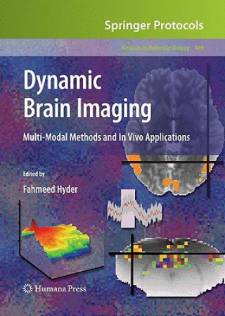 Книга Dynamic Brain Imaging Fahmeed Hyder
