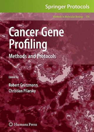 Könyv Cancer Gene Profiling Robert Grützmann