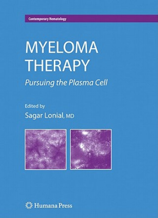 Carte Myeloma Therapy Sagar Lonial