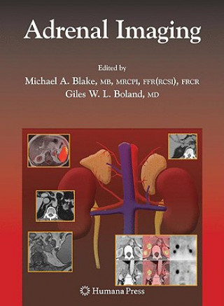 Carte Adrenal Imaging Michael A. Blake
