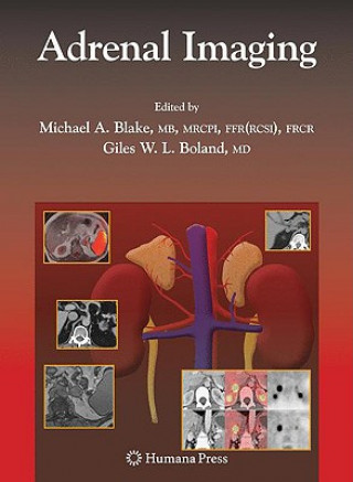 Livre Adrenal Imaging Michael A. Blake