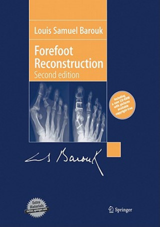 Książka Forefoot Reconstruction Louis S. Barouk