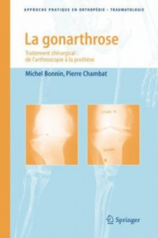 Kniha Gonarthrose Michel Bonnin