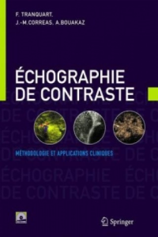 Könyv Échographie de contraste Francois Tranquart