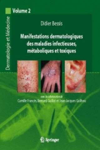 Carte Manifestations dermatologiques des maladies infectieuses, métaboliques et toxiques Didier Bessis