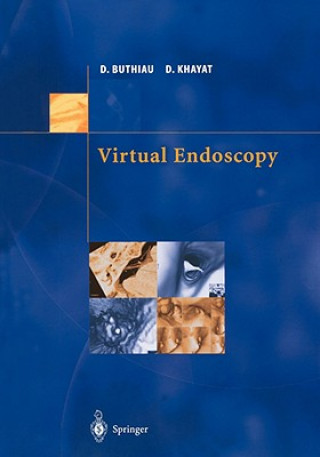 Knjiga Virtual Endoscopy Didier Buthiau