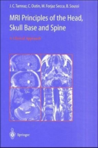 Kniha MRI Principles of the Head, Skull Base and Spine Jean C. Tamraz