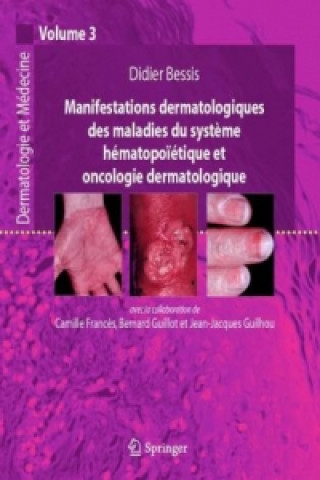 Kniha Manifestations dermatologiques des maladies du syst Didier Bessis